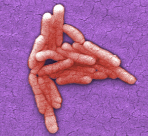 Picture of Salmonella typhimurium-which could spread from putting a bird feeder in the dishwasher