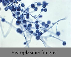 Histoplasmia fungus - one reason not to clean a bird feeder in the dishwasher